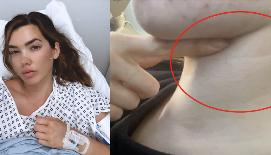 Young woman says she was rejected from the doctor’s office and told to drink cough syrup for what she thought was a viral infection, she was later diagnosed with incurable disease