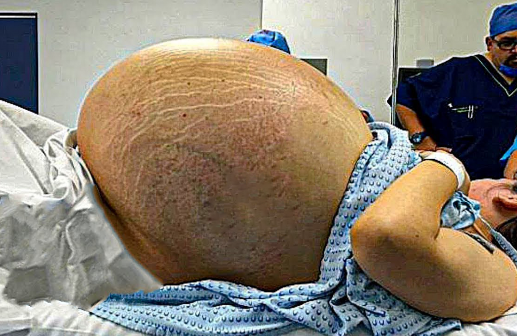 Mom went to hospital thinking she’s having a baby, then the doctor spotted something unusual!