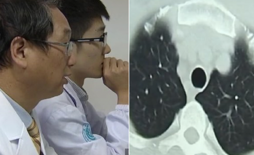 Doctors pulled 700 worms out of man’s body, say it’s all because he ate this one particular meal!